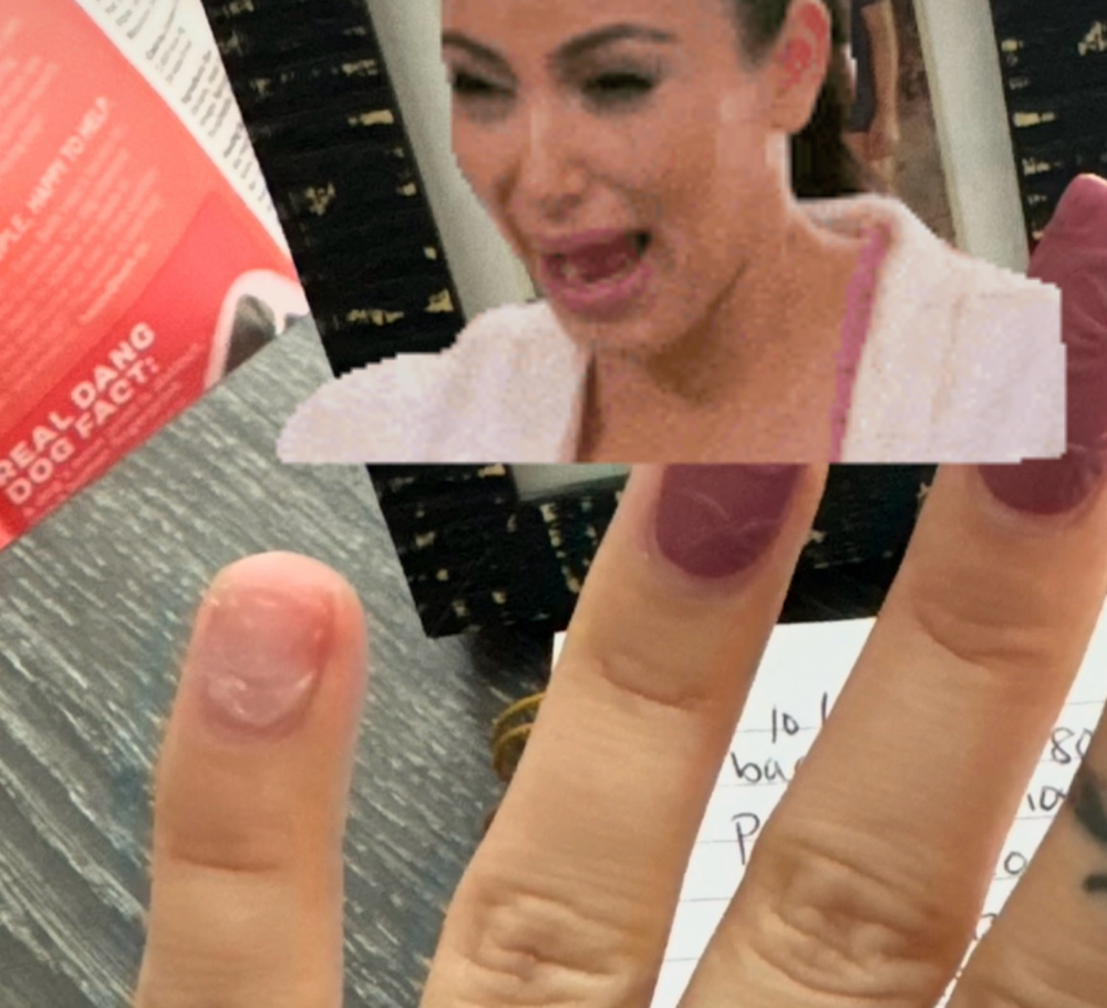 Nail repair