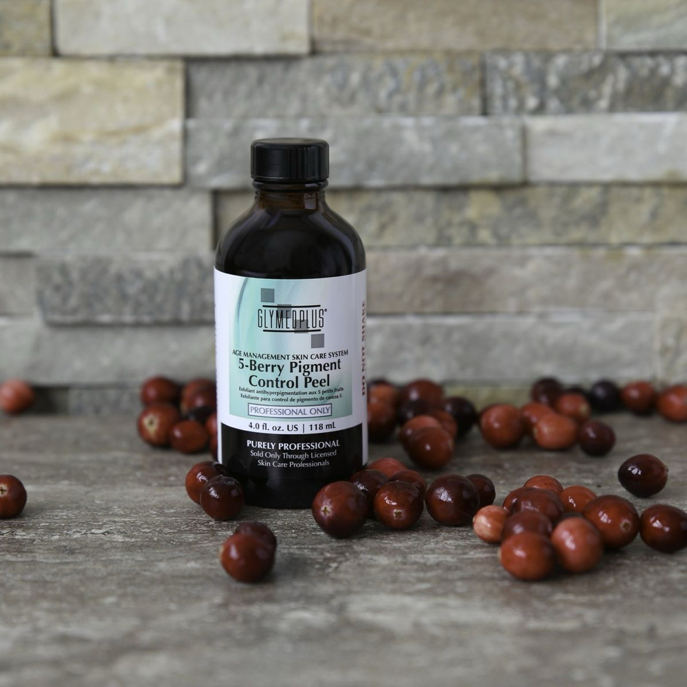 TCA Peel with Cold Plasma Therapy