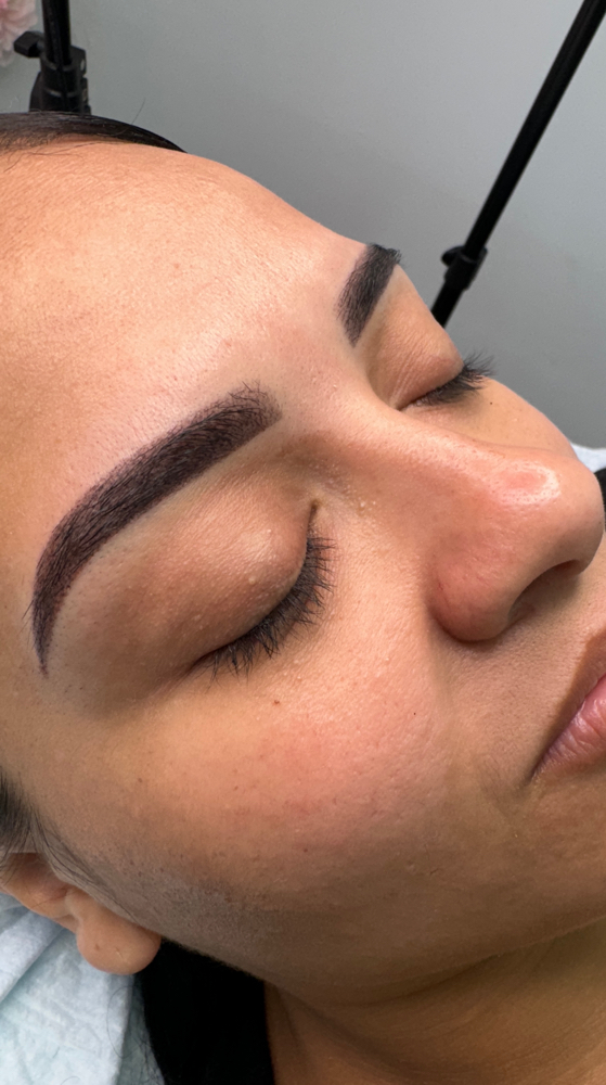 Touch Up (After 8 Months)