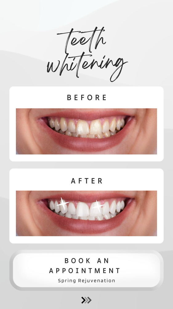 Teeth  Whitening