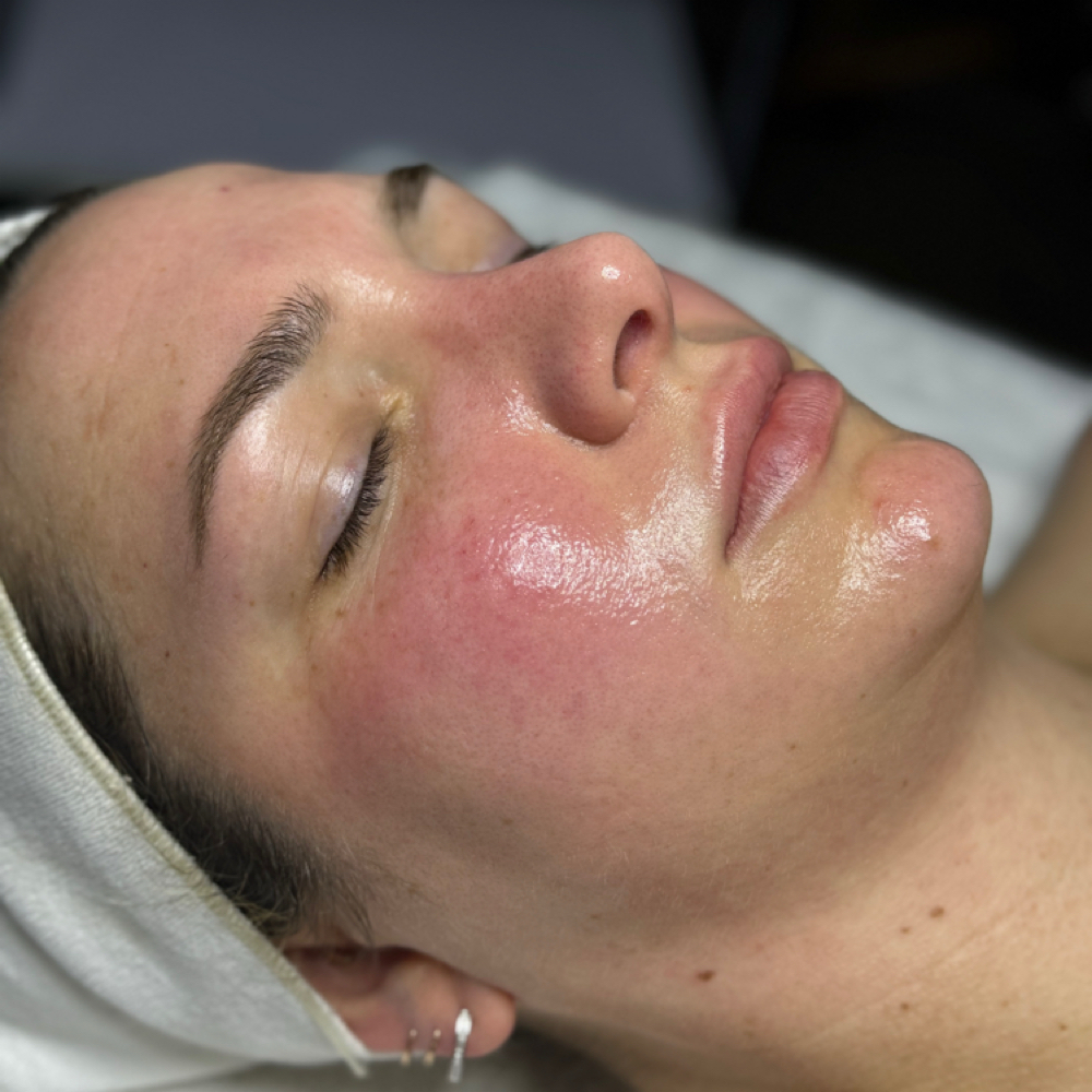 Bare Glass Skin Facial at Bare Skin Aesthetics in West Palm Beach, FL