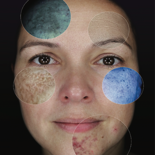 Infusion Facial-Acoustic Delivery at Skin by Maci in Charlotte, NC