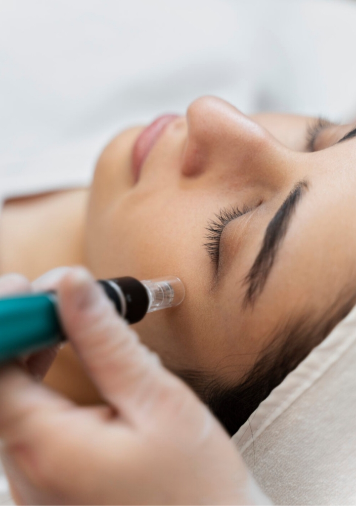 Microneedling