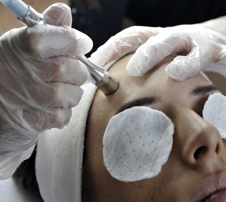Custom Microdermabrasion Trearment