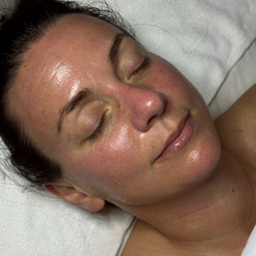 Infinity Facial at Skinfinity & Beyond in Davidson, NC