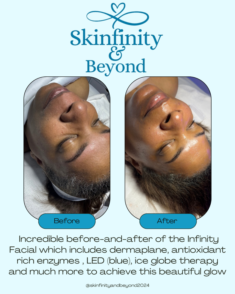 Infinity Facial