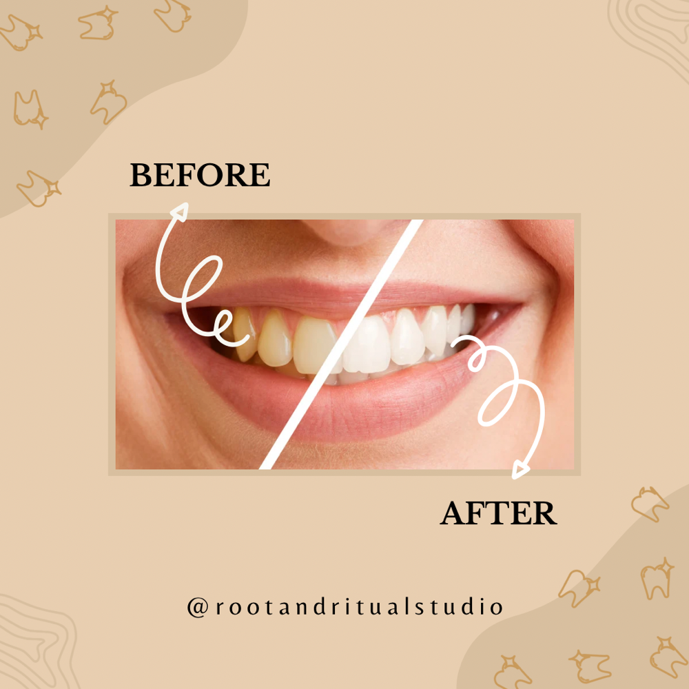 Ultimate Radiance Smile Session at Root & Ritual Beauty and Wellness in Ashland, KY