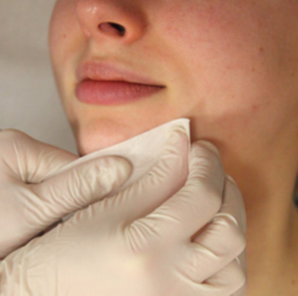 Chin Wax at Halo + Honey Skin Studio in Corpus Christi, TX