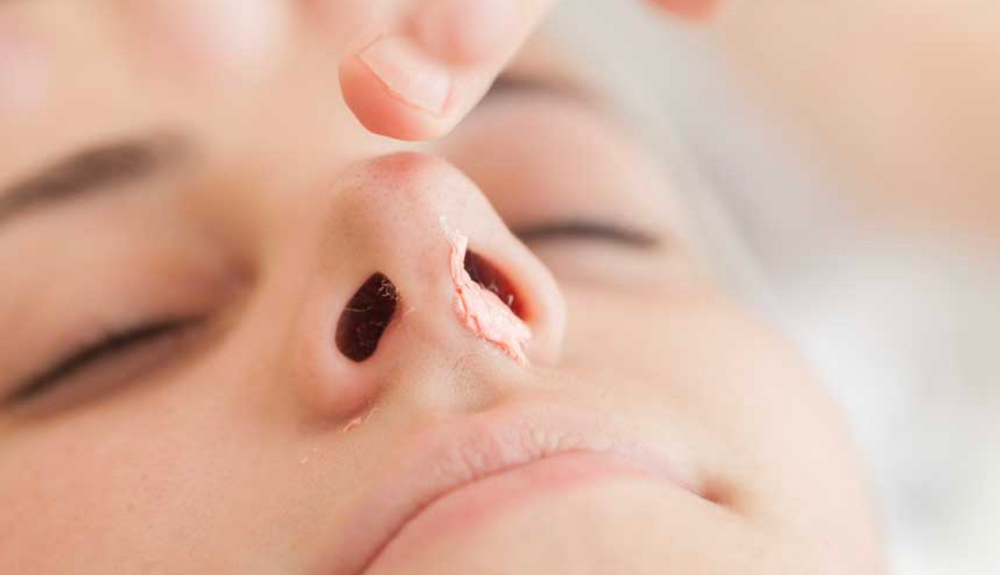 Nose Hair Removal