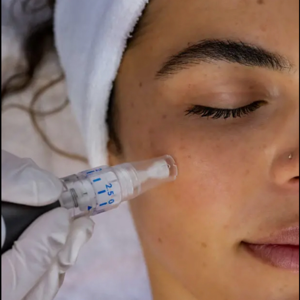 MicroNeedling/Led Light therapy at Prestige Aesthetics KC in Independence, MO