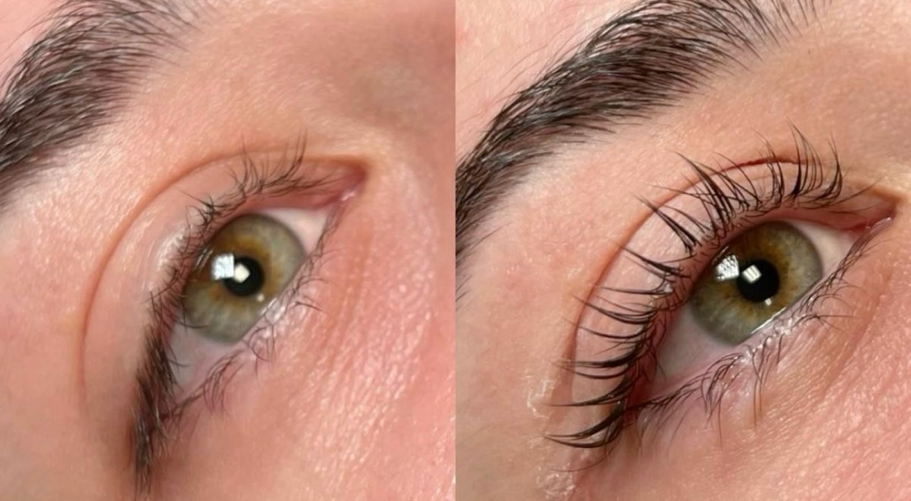 Lash Lift