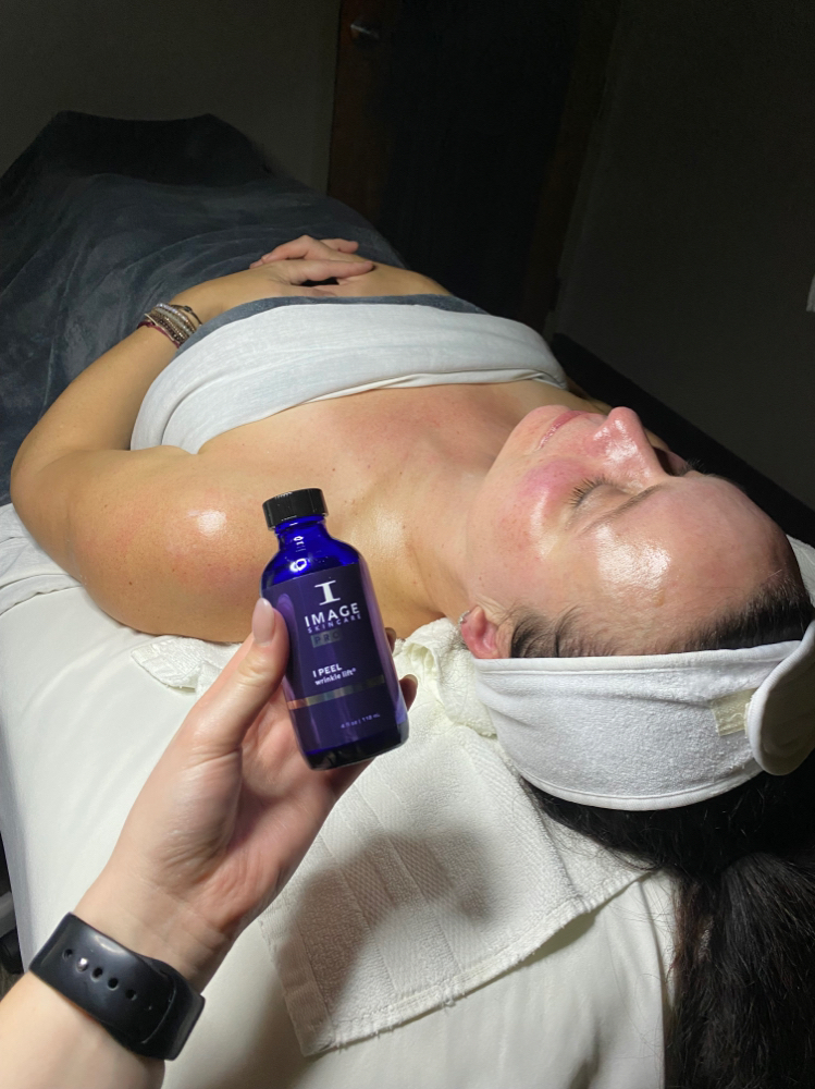 Chemical Peel