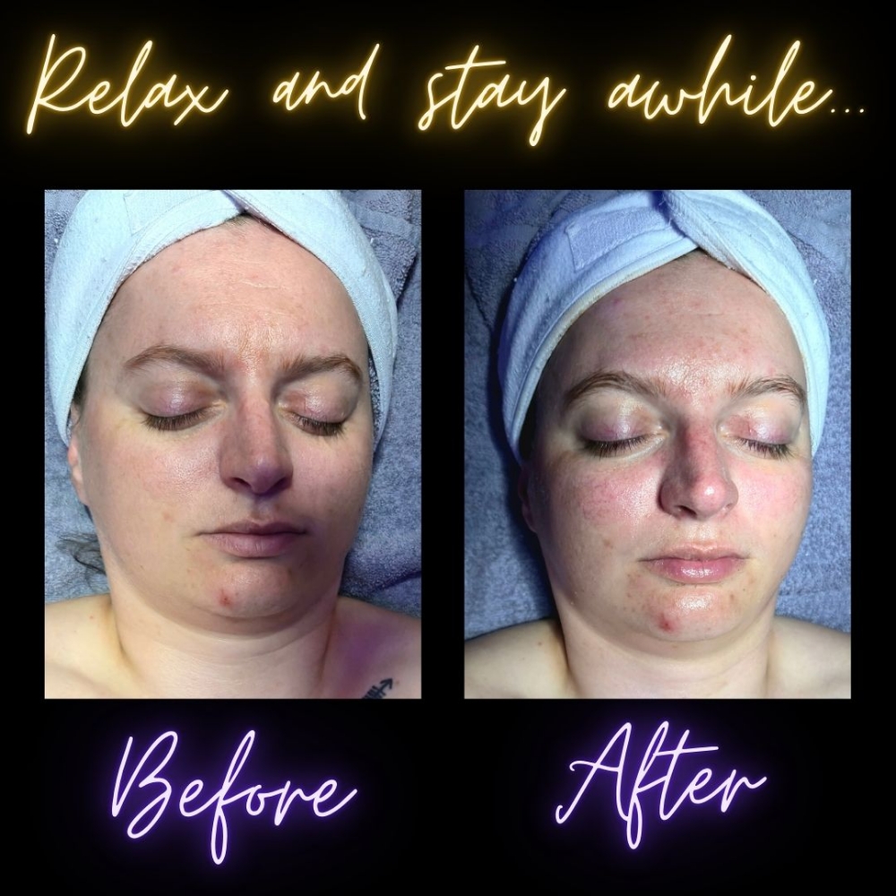 HOT TO GO! Express Facial