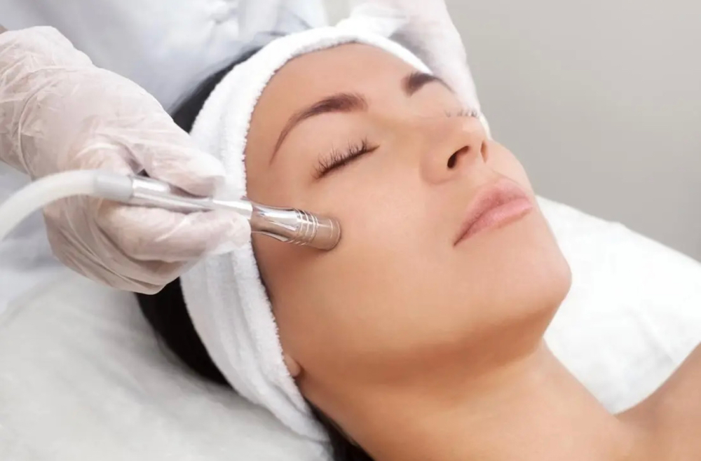 Microdermabrasion