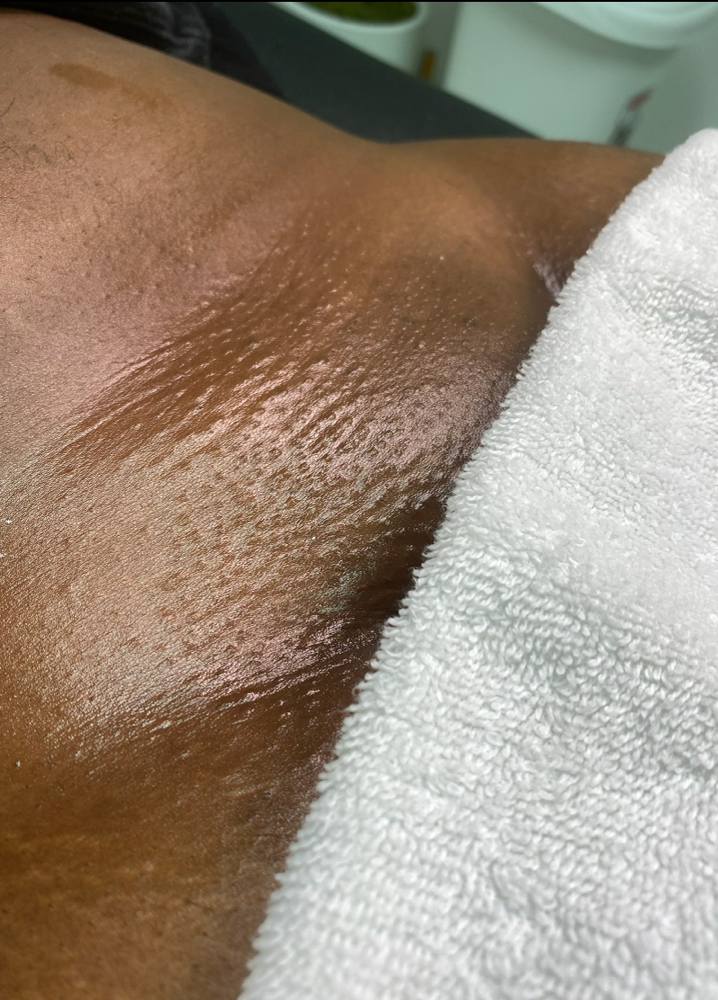 Brazillian at Sonder Skin in Newport News, VA