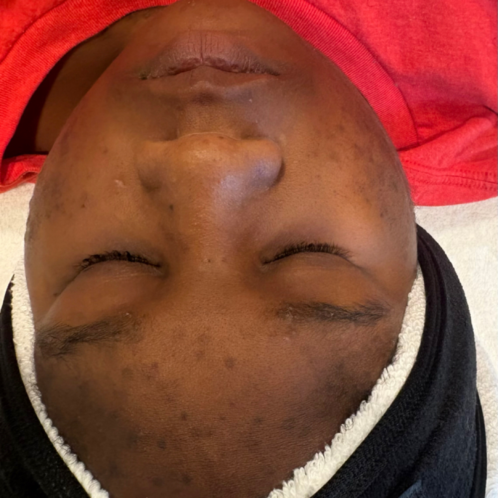 Glow Up Teen Facial at Naturre’ Skin Care LLC in Elizabeth City, NC