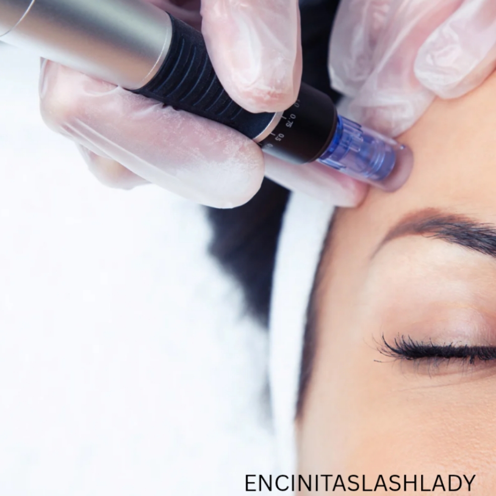 PDRN Microneedling Facial at Encinitas Lash Lady in Encinitas, CA