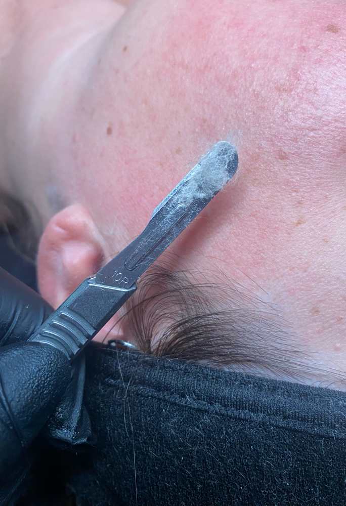 Add On Dermaplaning