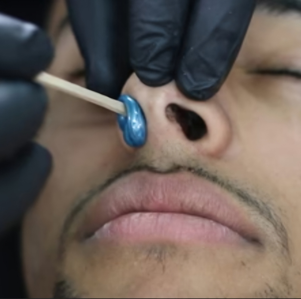 Nose Wax