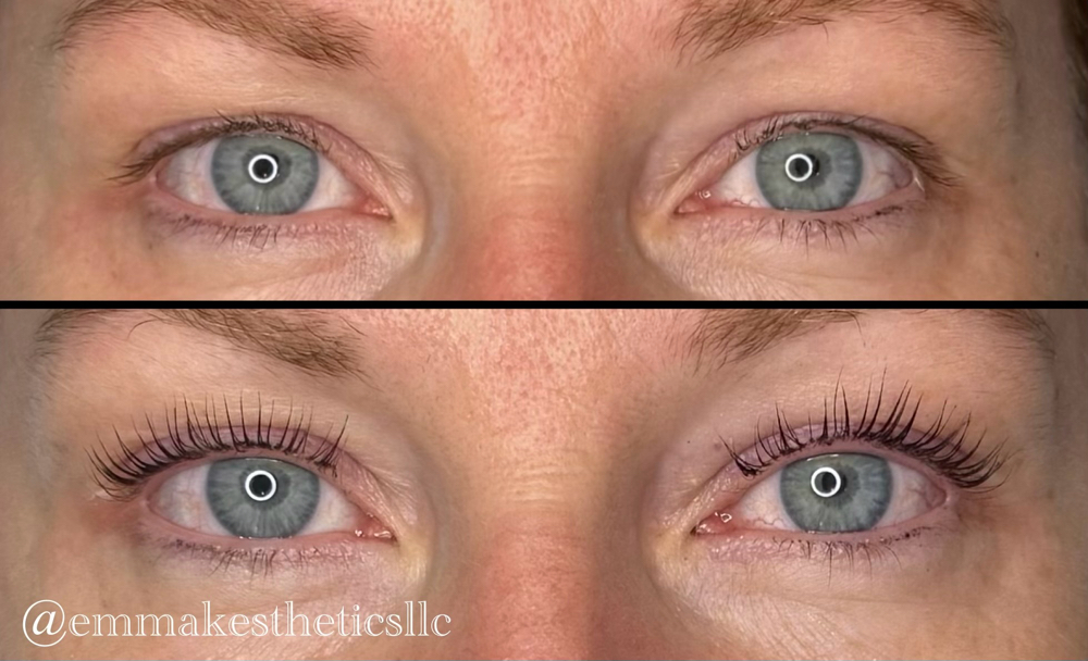 Lash lift