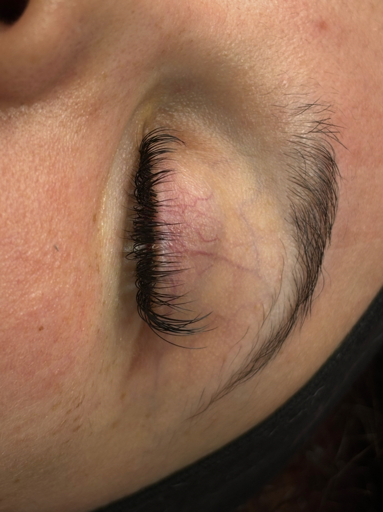 Classic Refill 2wk