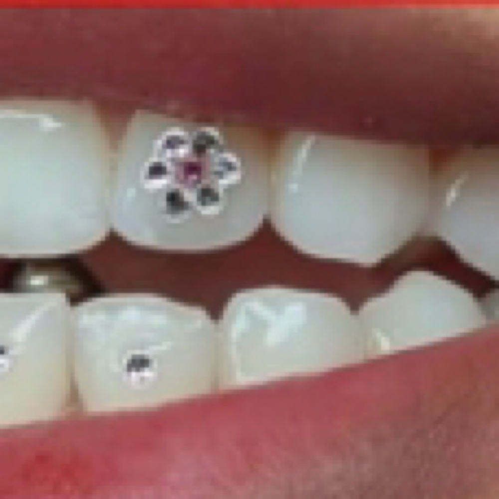 Tooth Gem Flower at Icey Whites By Blondee in Lawrence, MA