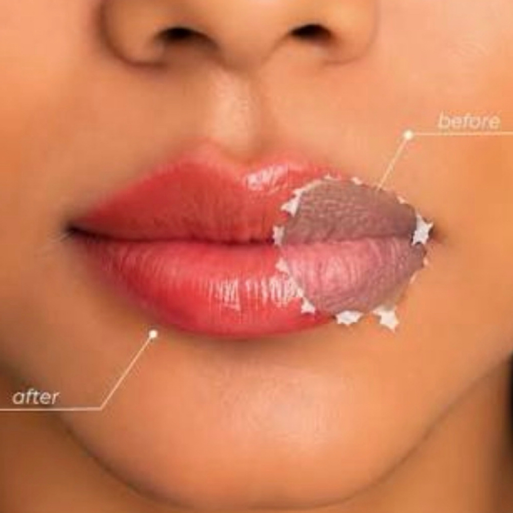 DARK LIP NEUTRALIZATION - SESSION 2 at Daisy Nano Brows in Southlake, TX