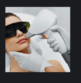 Upper Lip & Chin Laser