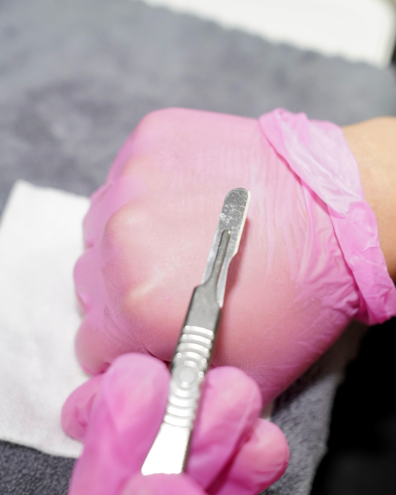 Dermaplane Treatment
