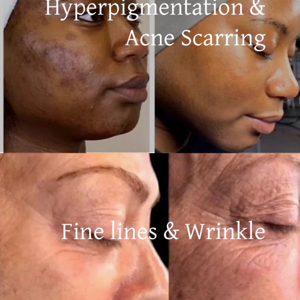Dermal Consult at Potent Transitions in East Orange, NJ