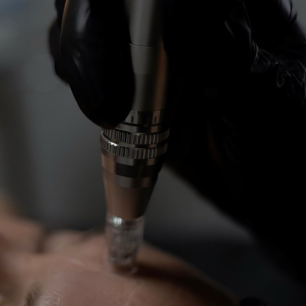 Microneedling Facial at Luxe Glow Esthetics LLC in South Carolina, SC