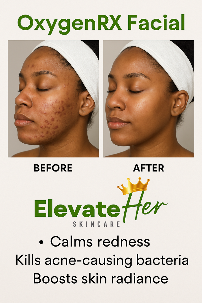 OxygenRX Facial w/ LED Therapy