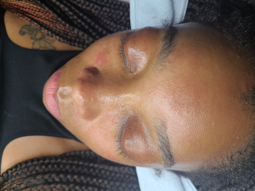 MOTHERS DAY Dermaplane Glow Facial