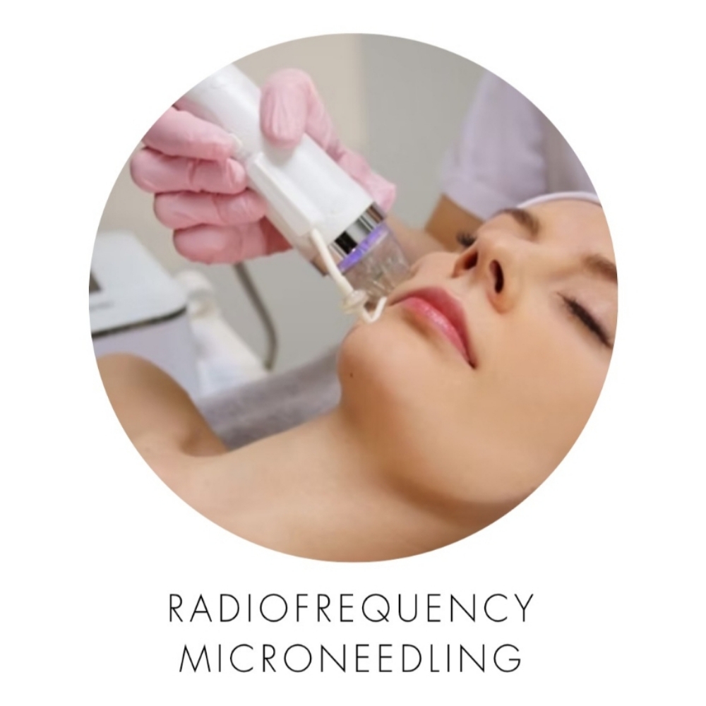 Radiofrequency Microneedling Face at Beauty Care by Monika Wojcieszak in Rockaway, NJ