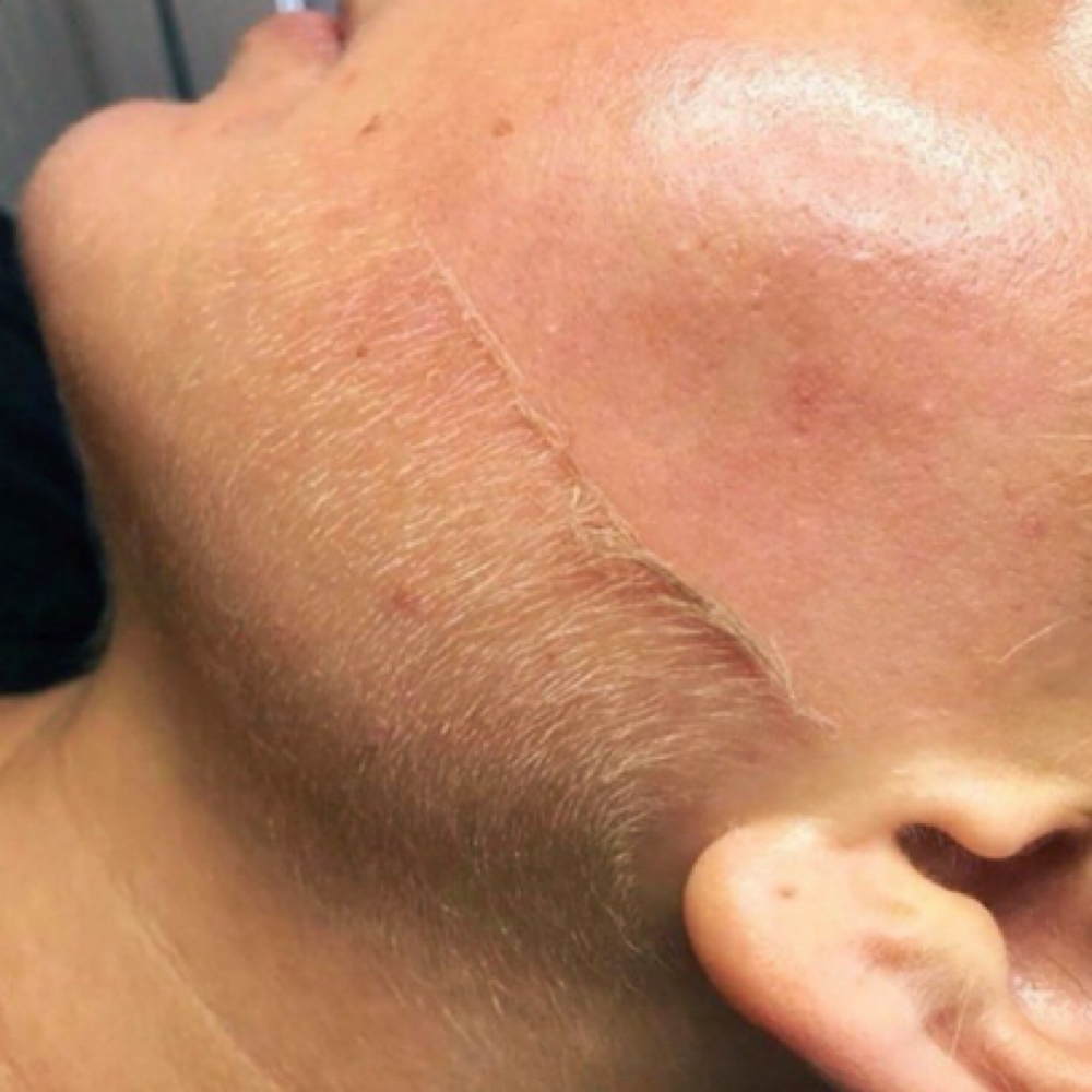 Deluxe Dermaplane Facial at Hairbend the Salon in Lancaster, CA