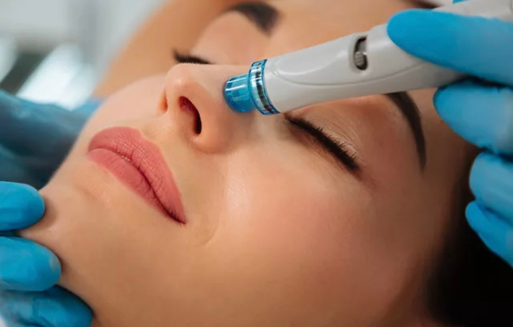 Hydro Oxygen Facial