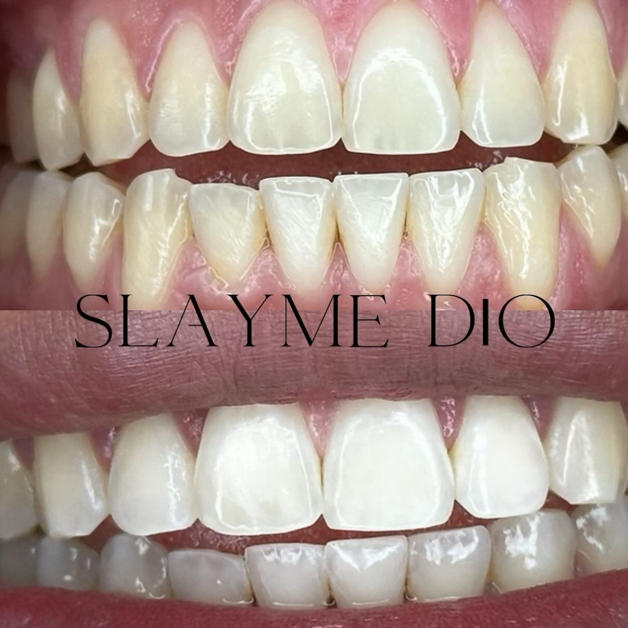 Cosmetic teeth whitening 60min