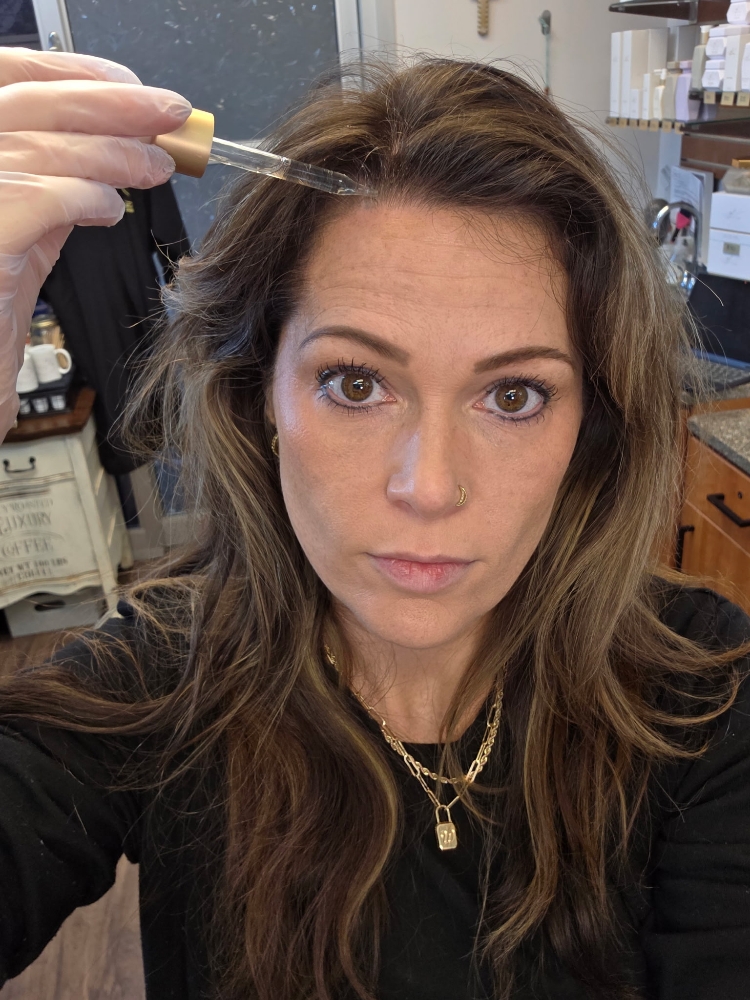 Scalp Microneedling- First Appointm