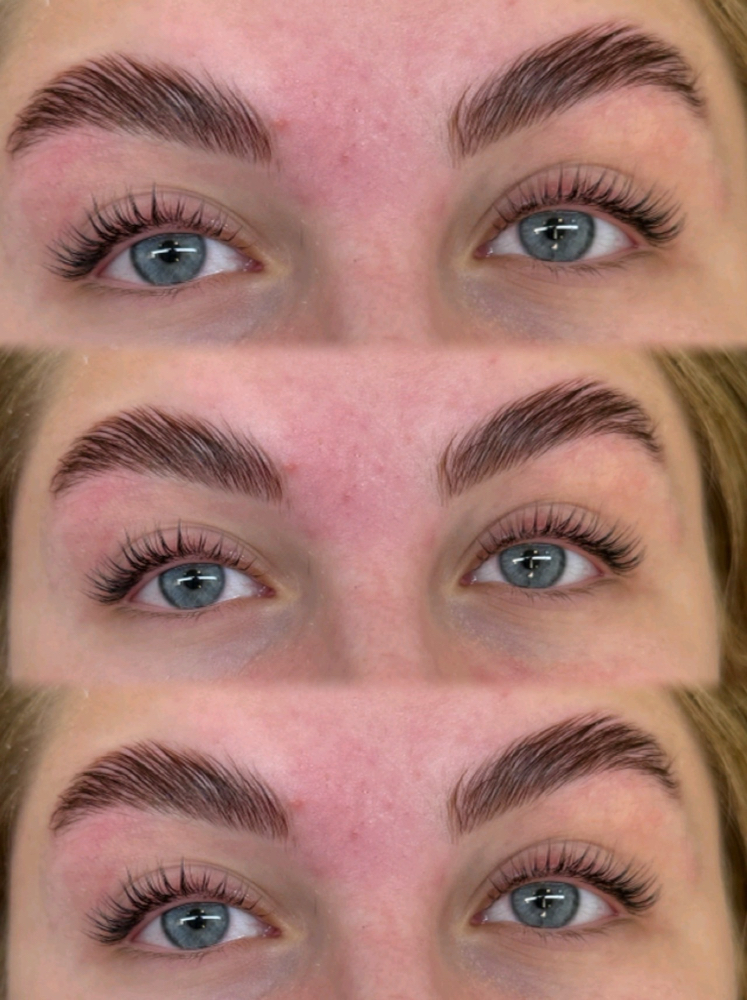 Brow Enhancements