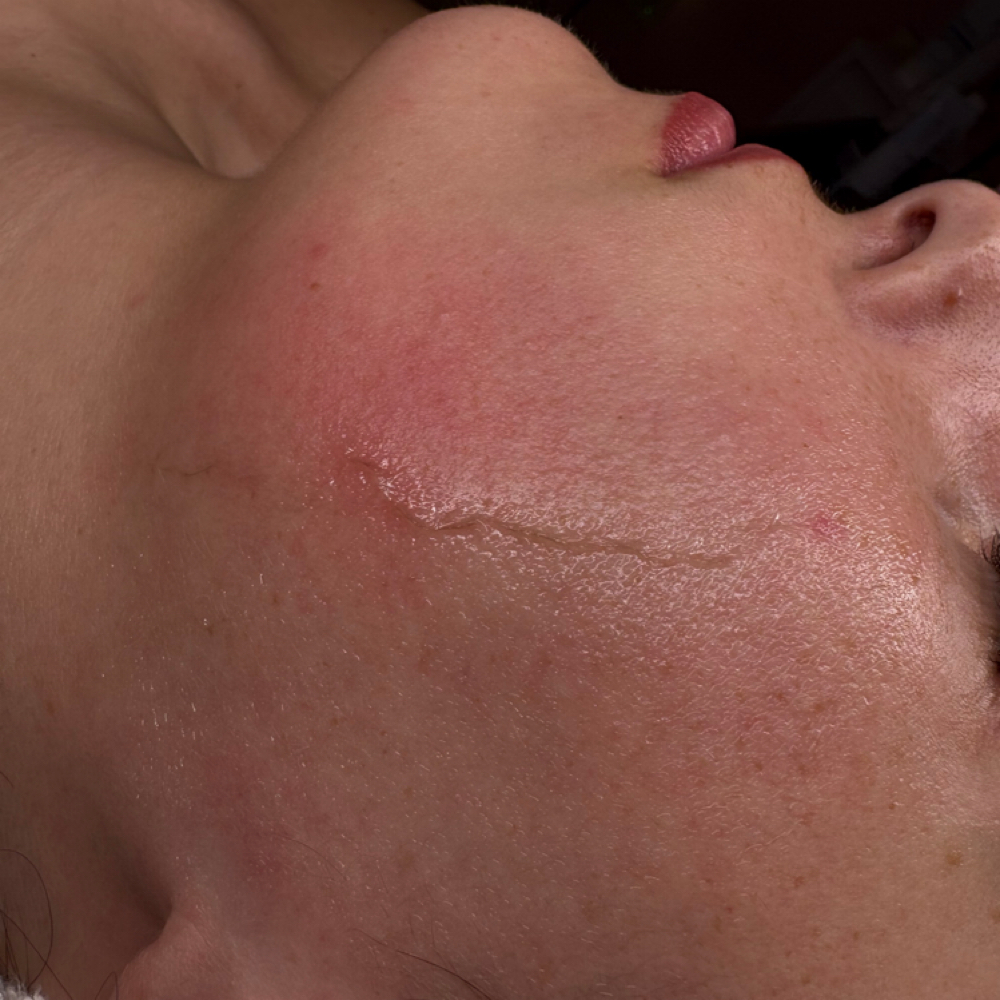 Signature Dermaplane Facial at Harli Cotten Aesthetics in Heidelberg, MS