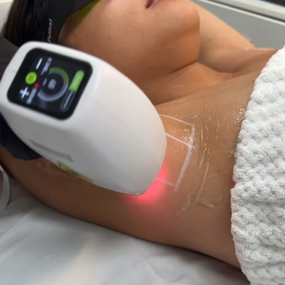 Laser Hair Removal at Flow Ink & Beauty in Henderson, NV