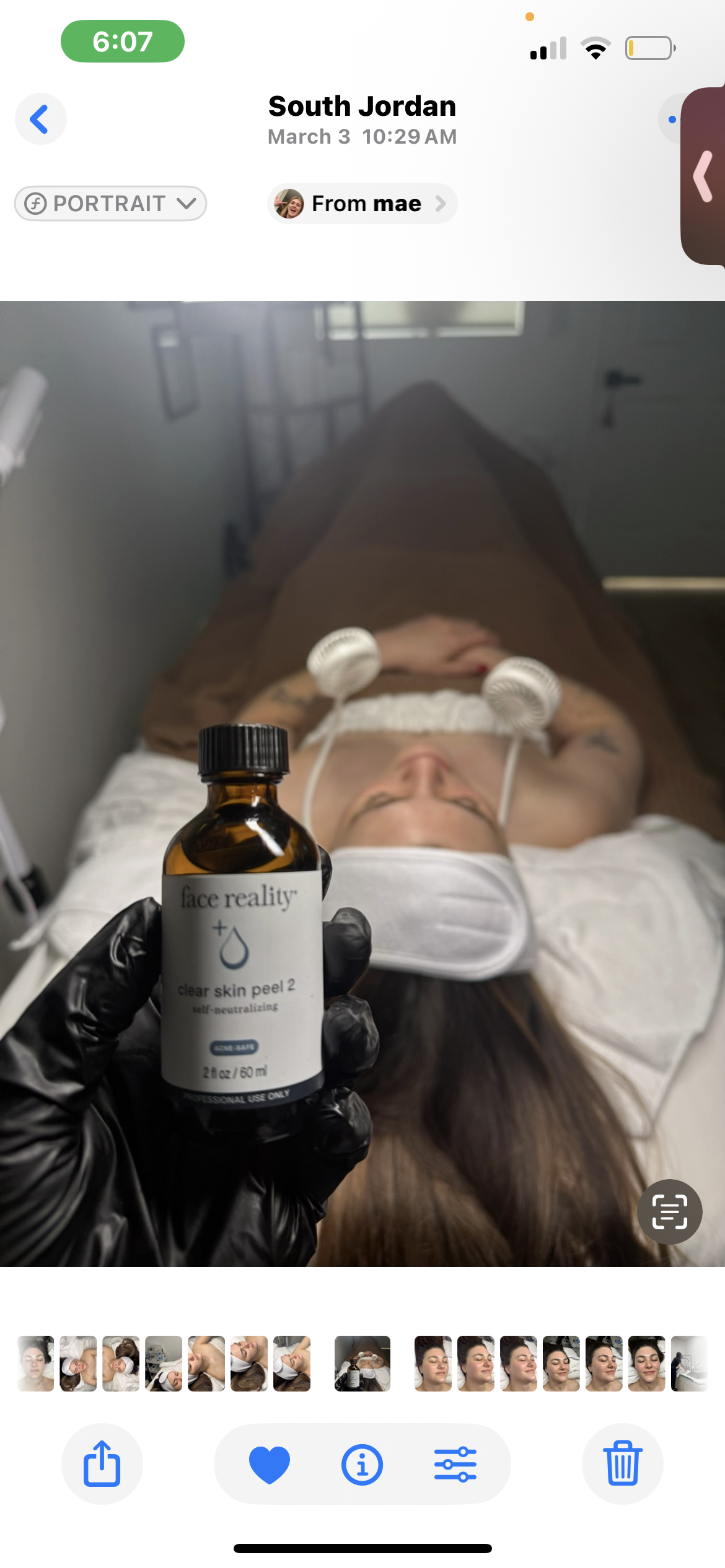 Dermaplaning + Chemical Peel at Refined Radiance - By Bay in South Jordan, UT