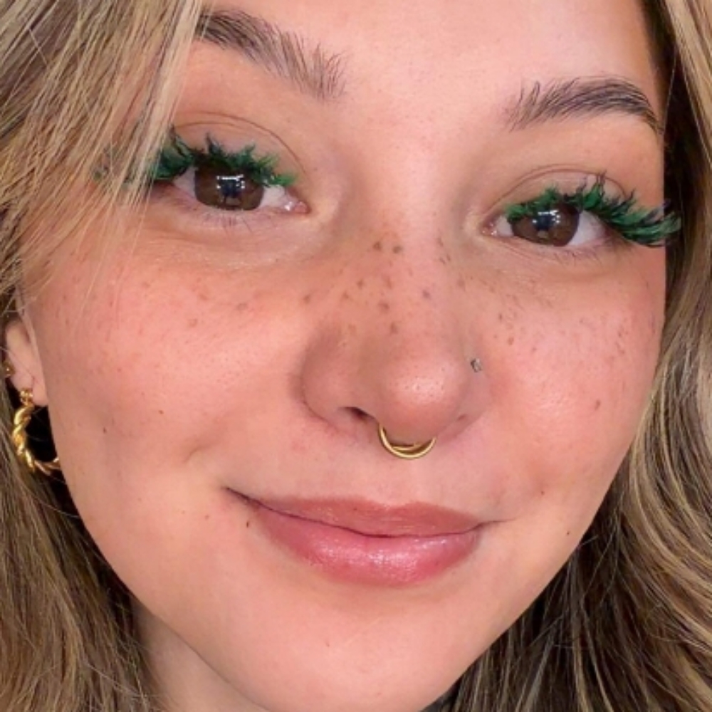 freckles at aurora sydel in Lakewood, CO