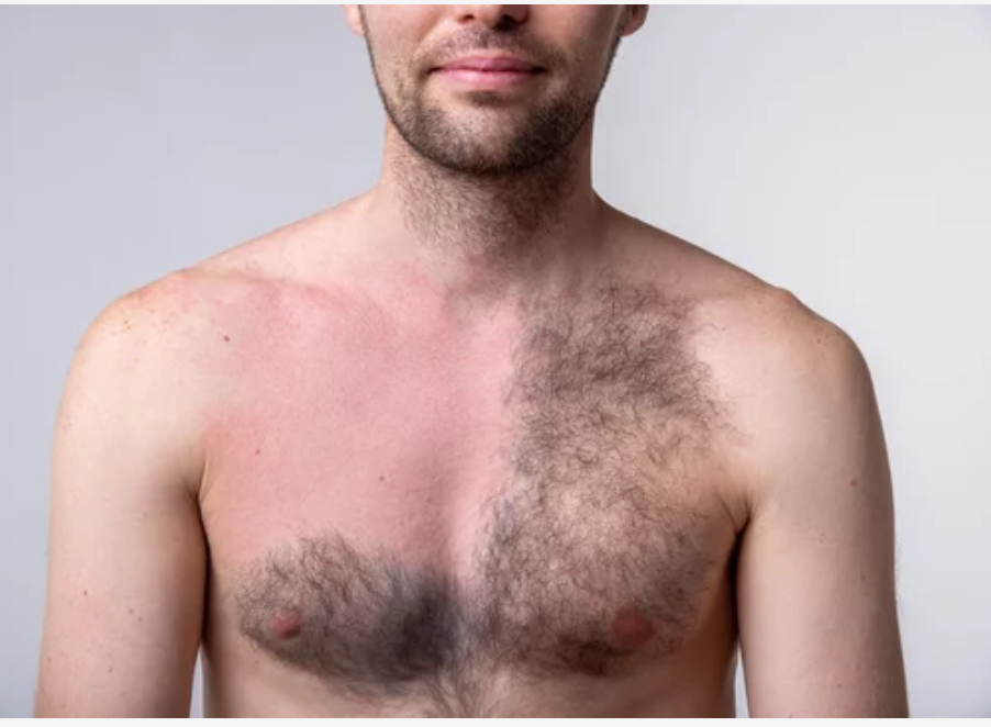 Chest Waxing