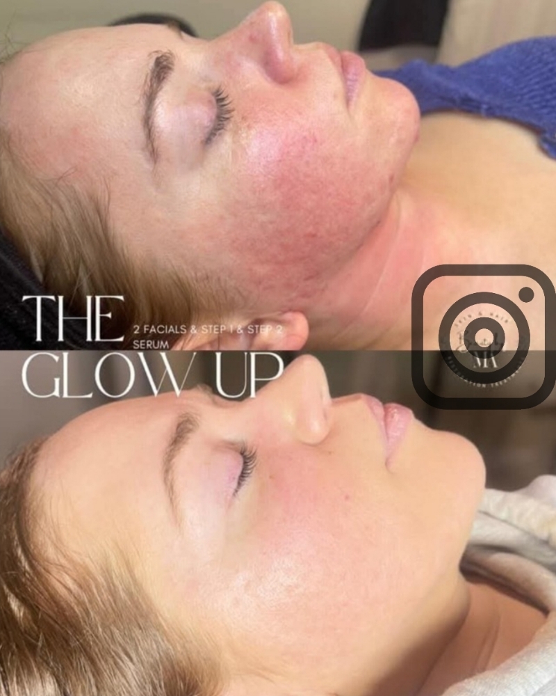 The Petite Facial