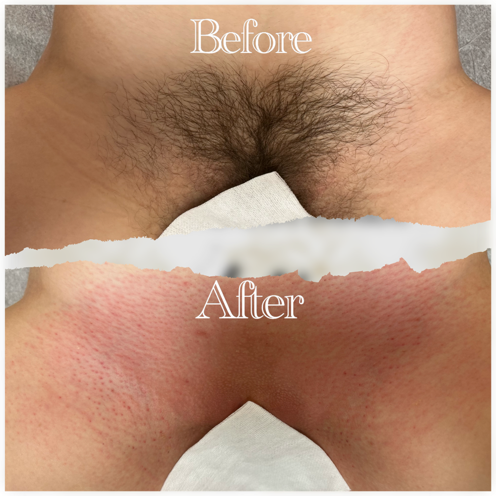 New Client Brazilian Bliss