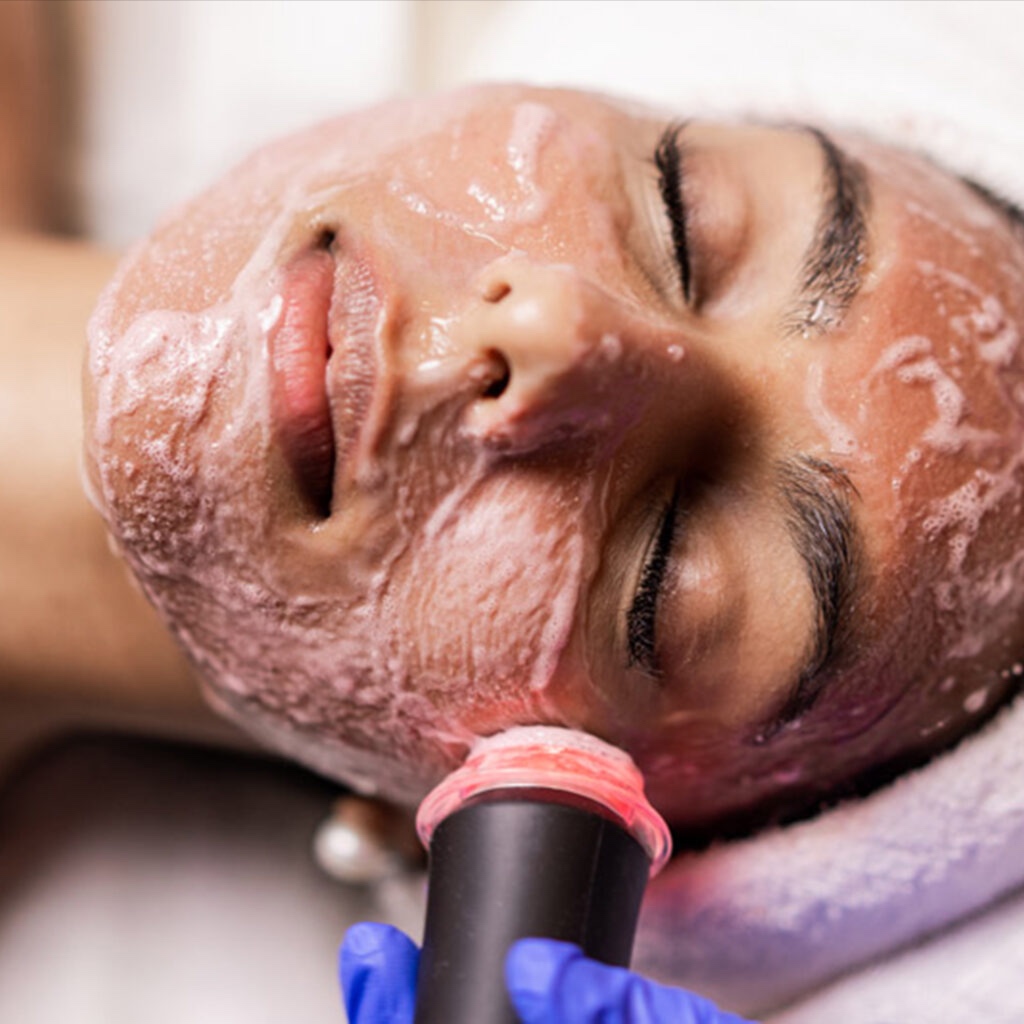 Oxigen calm facial (rosacea skin)