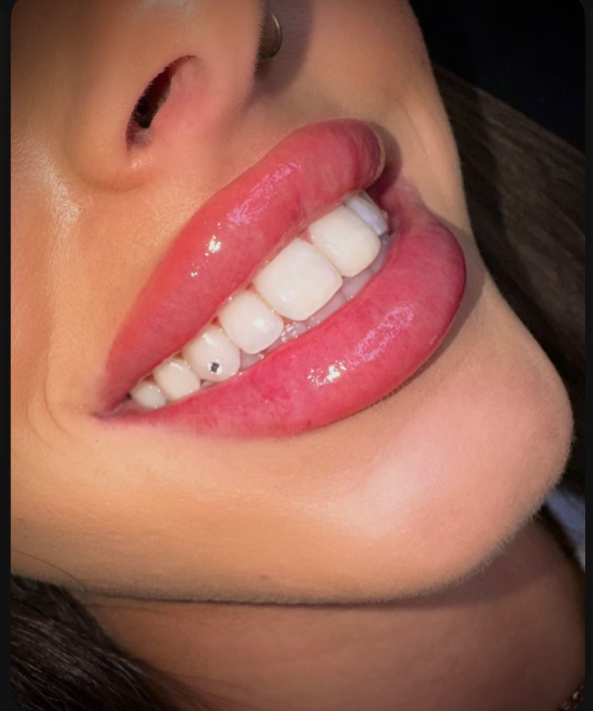 Single Tooth Gem