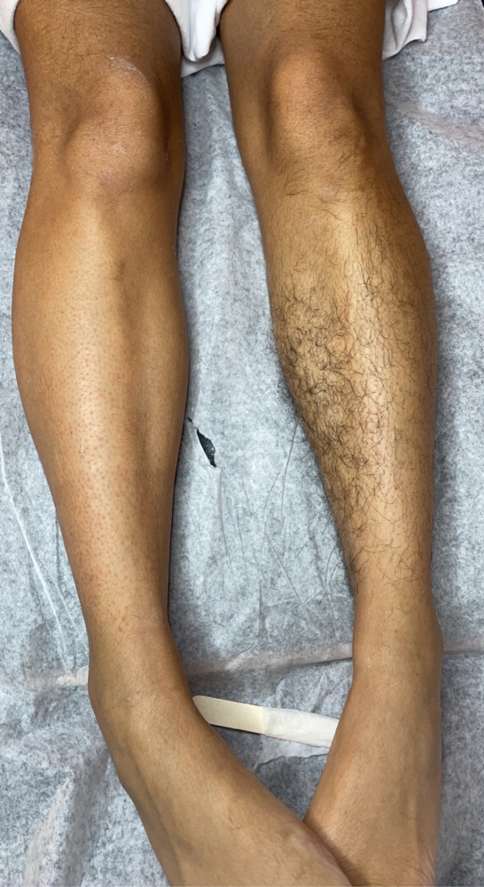Leg Wax