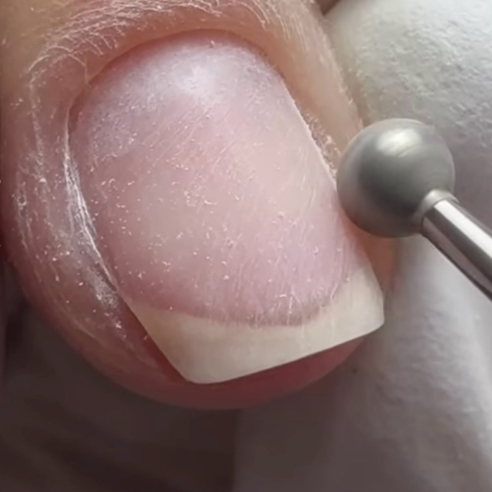Structured Manicure Removal
